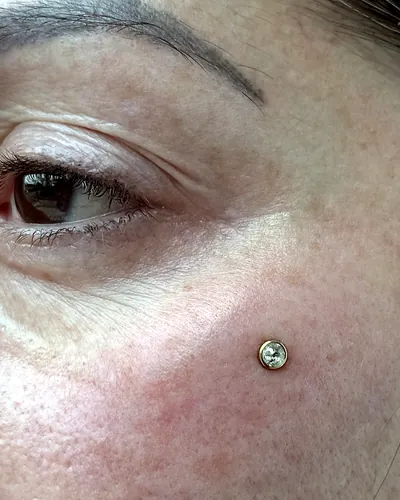 Dermal piercing, cheekbone at Rebel Tattoos, Sector 67 Gurgaon