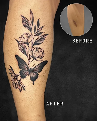 Botanicals and Butterfly, botanical scar cover-up tattoo on the calf, black and grey, at Rebel Tattoos, Sector 67 Gurgaon